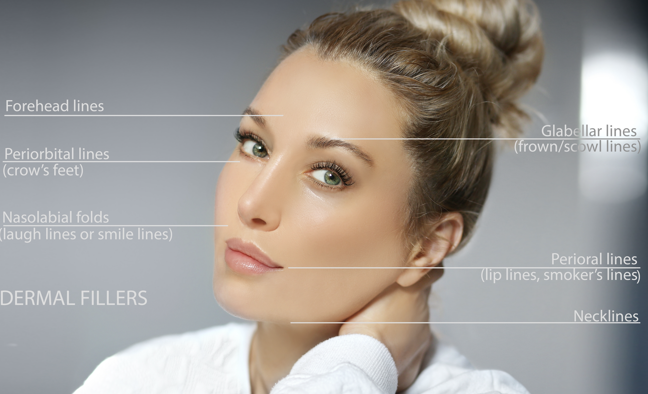 Dermal Fillers promotion