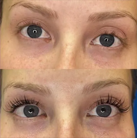 Lash Lift & Tint
