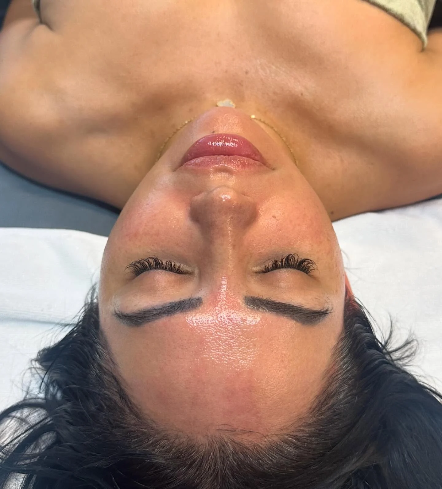 Glowing skin after a Signature Facelift treatment