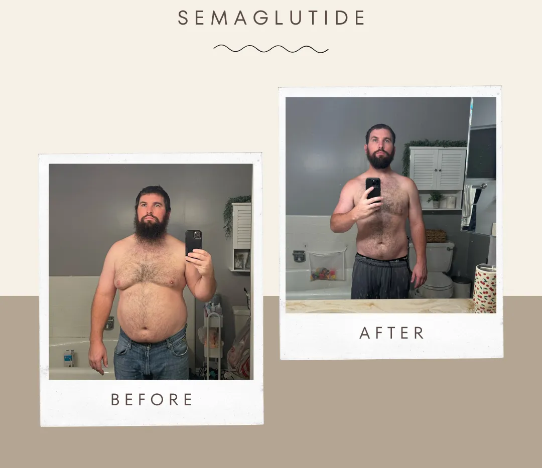 Weight Loss