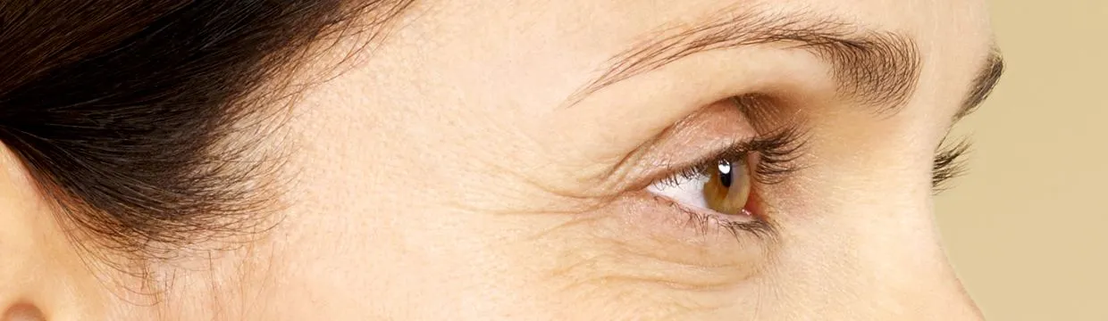 Skin texture before