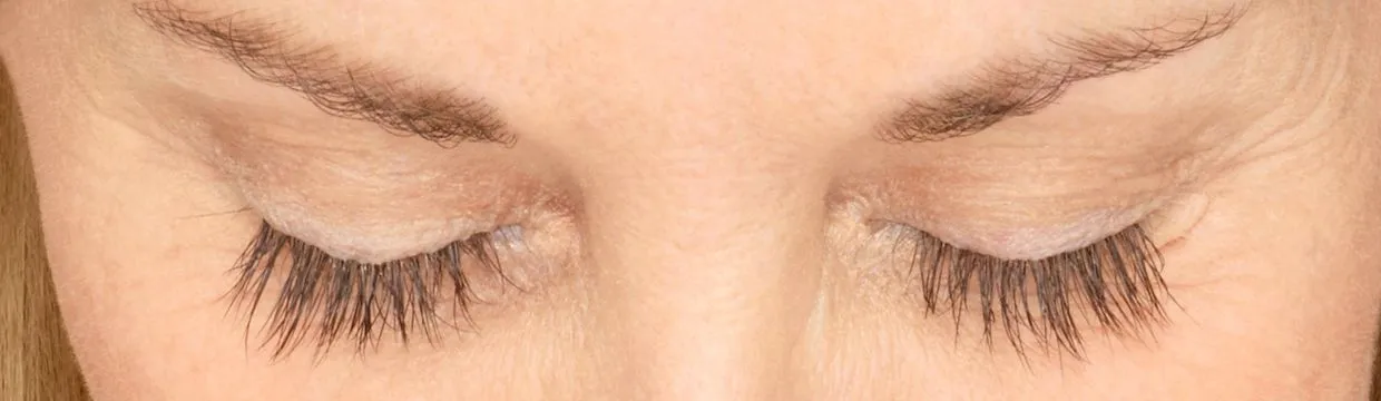 Skin texture after